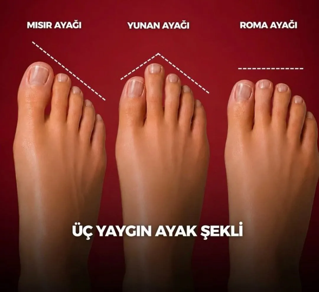 Tam boyut görüntüle 🔍 PozKes